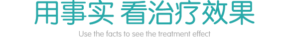 广州肤康皮肤病医院