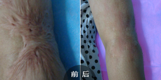 广州肤康皮肤病医院
