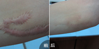 广州肤康皮肤病医院