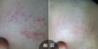 广州肤康皮肤病医院