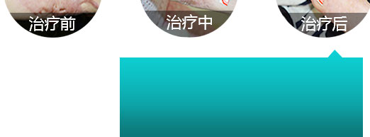 广州肤康皮肤病医院