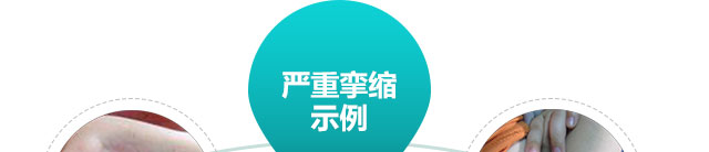 广州肤康皮肤病医院